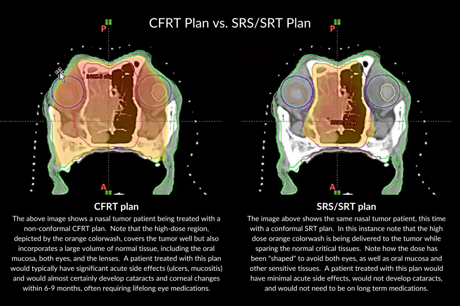 image of CRFT plan versus SRS/SRT plan